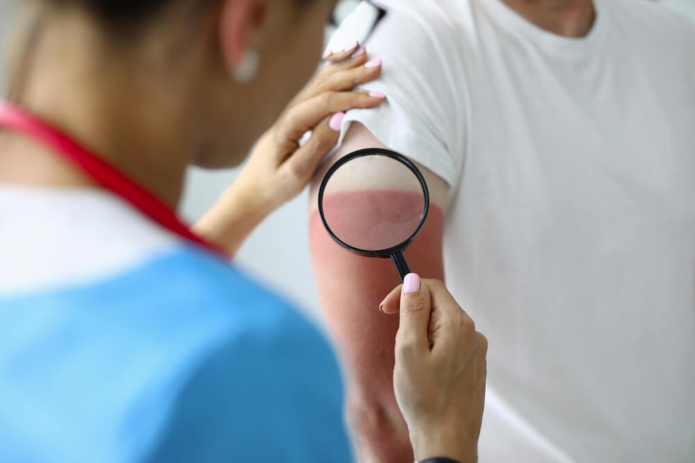 Cuanto Tarda En Desarrollarse Un Cáncer De Páncreas